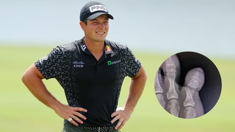 Viktor Hovland brach sich den Zeh im dunklen Hotelzimmer. (Foto: Getty/Instagram/@viktor_hovland)